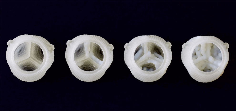 improved-diagnostics-presurgical-planning-high-resolution-functionally-graded-multi-material-3d-printing-biomedical-tomographic-datasets-10 improved-diagnostics-presurgical-planning-high-resolution-functionally-graded-multi-material-3d-printing-biomedical-tomographic-datasets-10